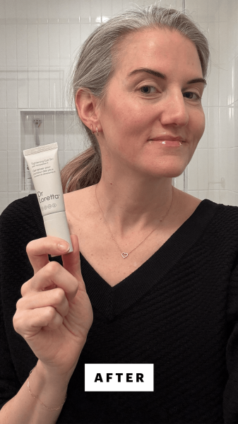 Bailly after applying the Dr. Loretta Tightening Eye Gel